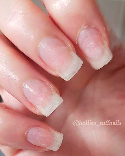 Removed acrylic nails after soaking in acetone