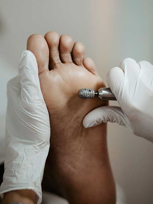 Waterless pedicure type Waterless pedicure type with cleaning steps using an electric file